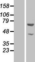 GLYR1 Protein - Western validation with an anti-DDK antibody * L: Control HEK293 lysate R: Over-expression lysate