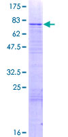 GLYR1 Protein - 12.5% SDS-PAGE of human N-PAC stained with Coomassie Blue
