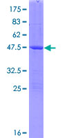 GM2A Protein - 12.5% SDS-PAGE of human GM2A stained with Coomassie Blue