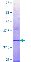 GM2A Protein - 12.5% SDS-PAGE Stained with Coomassie Blue.