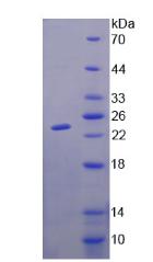 GM2A Protein - Recombinant  GM2 Ganglioside Activator By SDS-PAGE