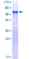 GMDS / GMD Protein - 12.5% SDS-PAGE of human GMDS stained with Coomassie Blue