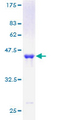 GMF Beta / GMFB Protein - 12.5% SDS-PAGE of human GMFB stained with Coomassie Blue