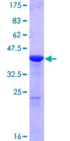 GMFG Protein - 12.5% SDS-PAGE of human GMFG stained with Coomassie Blue