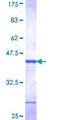 GMFG Protein - 12.5% SDS-PAGE Stained with Coomassie Blue.
