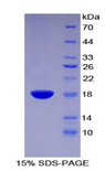 GMFG Protein - Recombinant  Glia Maturation Factor Gamma By SDS-PAGE