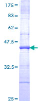 GML Protein - 12.5% SDS-PAGE Stained with Coomassie Blue.