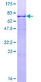 GMPPA Protein - 12.5% SDS-PAGE of human GMPPA stained with Coomassie Blue