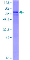 GMPPB Protein - 12.5% SDS-PAGE of human GMPPB stained with Coomassie Blue