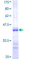 GMPPB Protein - 12.5% SDS-PAGE Stained with Coomassie Blue.