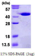 GMPR1 / GMPR Protein
