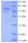 GMPR1 / GMPR Protein