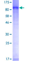 GMPS / GMP Synthase Protein - 12.5% SDS-PAGE of human GMPS stained with Coomassie Blue