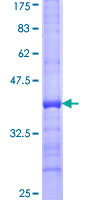 GMPS / GMP Synthase Protein - 12.5% SDS-PAGE Stained with Coomassie Blue.