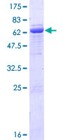 GNA11 Protein - 12.5% SDS-PAGE of human GNA11 stained with Coomassie Blue