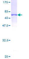 GNA13 Protein - 12.5% SDS-PAGE of human GNA13 stained with Coomassie Blue