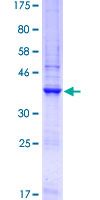 GNA14 Protein - 12.5% SDS-PAGE Stained with Coomassie Blue.
