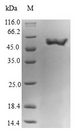 GNA15 Protein - (Tris-Glycine gel) Discontinuous SDS-PAGE (reduced) with 5% enrichment gel and 15% separation gel.