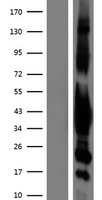GNAI1 / Gi Protein - Western validation with an anti-DDK antibody * L: Control HEK293 lysate R: Over-expression lysate
