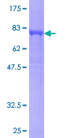 GNAL Protein - 12.5% SDS-PAGE of human GNAL stained with Coomassie Blue