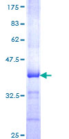GNAL Protein - 12.5% SDS-PAGE Stained with Coomassie Blue.