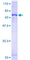 GNAQ Protein - 12.5% SDS-PAGE of human GNAQ stained with Coomassie Blue