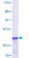 GNAQ Protein - 12.5% SDS-PAGE Stained with Coomassie Blue.