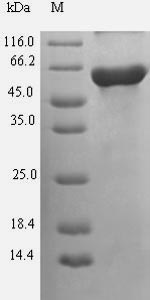 GNAS Protein - (Tris-Glycine gel) Discontinuous SDS-PAGE (reduced) with 5% enrichment gel and 15% separation gel.