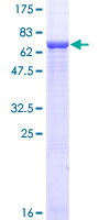 GNAS Protein - 12.5% SDS-PAGE of human GNAS stained with Coomassie Blue