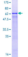 GNAT2 Protein - 12.5% SDS-PAGE of human GNAT2 stained with Coomassie Blue