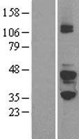 GNAZ Protein - Western validation with an anti-DDK antibody * L: Control HEK293 lysate R: Over-expression lysate