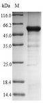 GNAZ Protein - (Tris-Glycine gel) Discontinuous SDS-PAGE (reduced) with 5% enrichment gel and 15% separation gel.