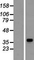 GNB1 Protein - Western validation with an anti-DDK antibody * L: Control HEK293 lysate R: Over-expression lysate