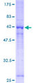 GNB1 Protein - 12.5% SDS-PAGE of human GNB1 stained with Coomassie Blue