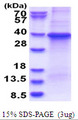 GNB1 Protein