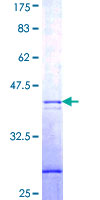 GNB1L / FKSG1 Protein - 12.5% SDS-PAGE Stained with Coomassie Blue.