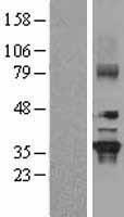 GNB2 Protein - Western validation with an anti-DDK antibody * L: Control HEK293 lysate R: Over-expression lysate