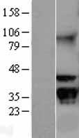 GNB2L1 / RACK1 Protein - Western validation with an anti-DDK antibody * L: Control HEK293 lysate R: Over-expression lysate