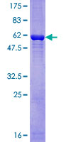 GNB2L1 / RACK1 Protein - 12.5% SDS-PAGE of human GNB2L1 stained with Coomassie Blue