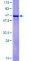 GNB2L1 / RACK1 Protein - 12.5% SDS-PAGE of human GNB2L1 stained with Coomassie Blue