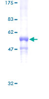 GNB3 Protein - 12.5% SDS-PAGE of human GNB3 stained with Coomassie Blue