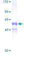 GNB3 Protein - 12.5% SDS-PAGE of human GNB3 stained with Coomassie Blue