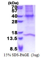 GNB3 Protein