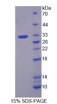 GNB3 Protein - Recombinant G Protein Beta 3 (GNb3) by SDS-PAGE