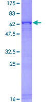 GNB4 Protein - 12.5% SDS-PAGE of human GNB4 stained with Coomassie Blue