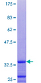 GNG10 Protein - 12.5% SDS-PAGE of human GNG10 stained with Coomassie Blue