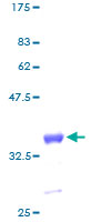 GNG11 Protein - 12.5% SDS-PAGE of human GNG11 stained with Coomassie Blue