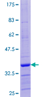 GNG12 Protein - 12.5% SDS-PAGE of human GNG12 stained with Coomassie Blue