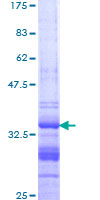 GNG12 Protein - 12.5% SDS-PAGE Stained with Coomassie Blue