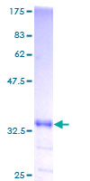 GNG2 Protein - 12.5% SDS-PAGE of human GNG2 stained with Coomassie Blue
